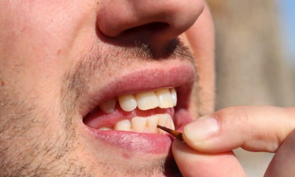 Taking Care of Your Teeth in Survival Situations: Simple and Effective Methods