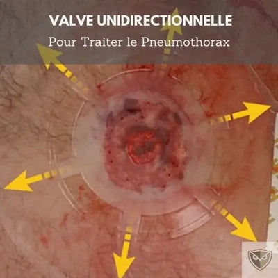 EMS™ Joint de Poitrine Ventilé survieprotek
