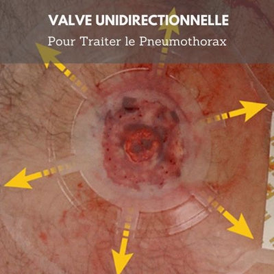 EMS™ Joint de Poitrine Ventilé survieprotek